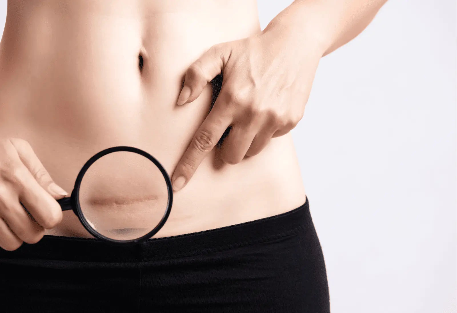 Close-up of post-cesarean scar tissue under magnification for massage gun therapy article